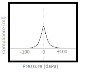 interpreting tympanogram|Interpreting the tests – Audiogram and Tympanogram .